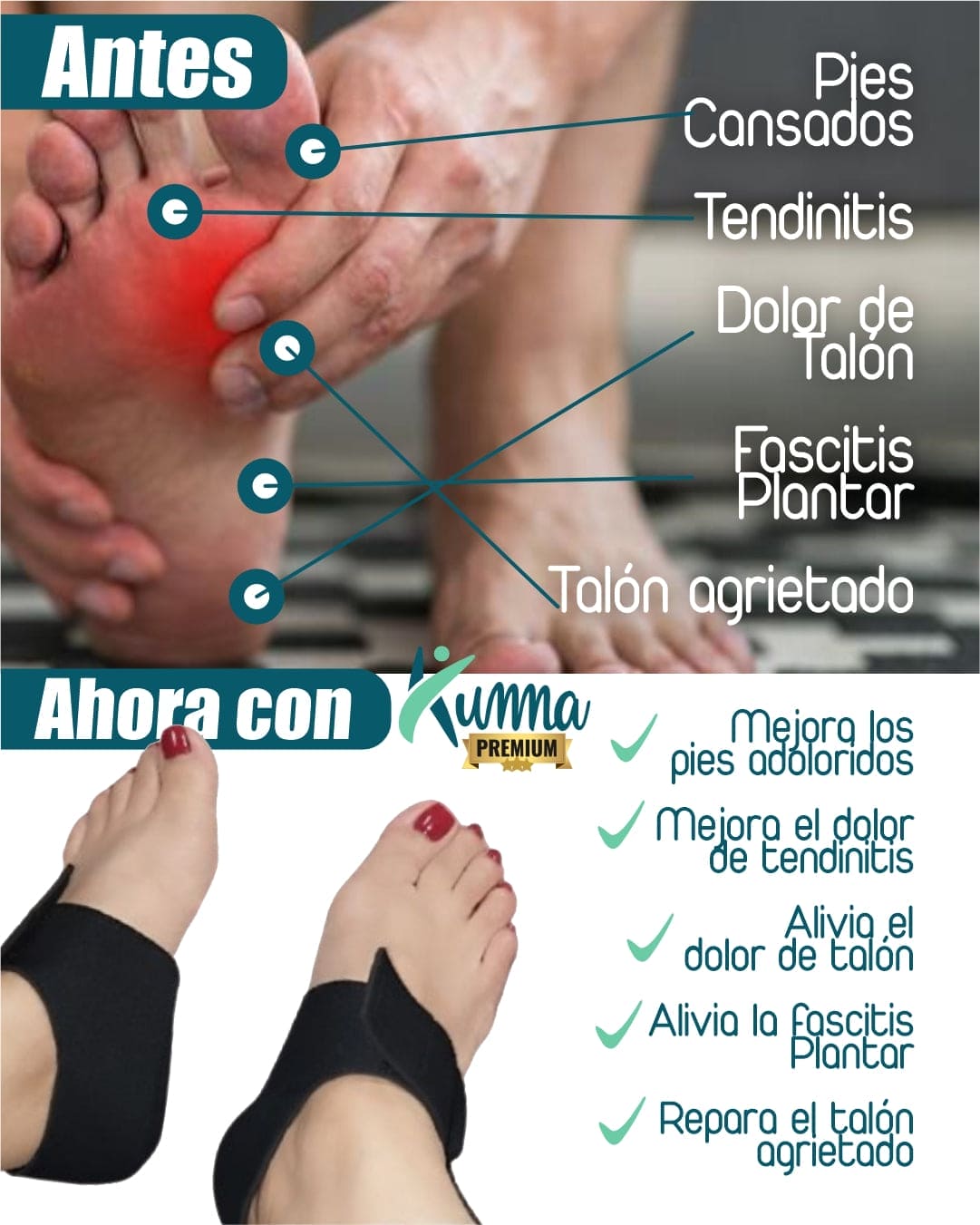 💥𝗧𝗔𝗟𝗢𝗡𝗘𝗥𝗔𝗦 𝗖𝗢𝗡 𝗚𝗘𝗟 𝗠𝗔𝗥𝗖𝗔 𝗞𝗨𝗠𝗠𝗔🦶🏻